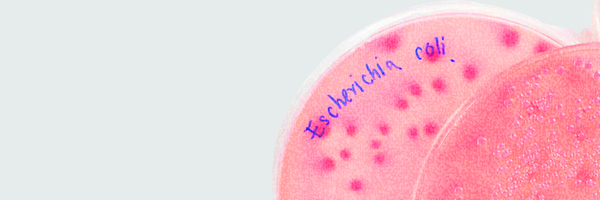 Petri dish showing E. coli bacteria linked to urinary tract and vaginal infections