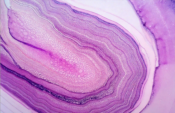 Microscopic view of vaginal tissue in purple and pink tones