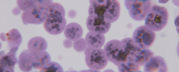 Microscopic view representing bacteria in the vaginal microbiome