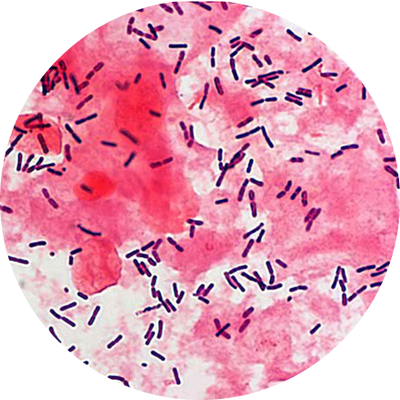 Lactobacillus crispatus