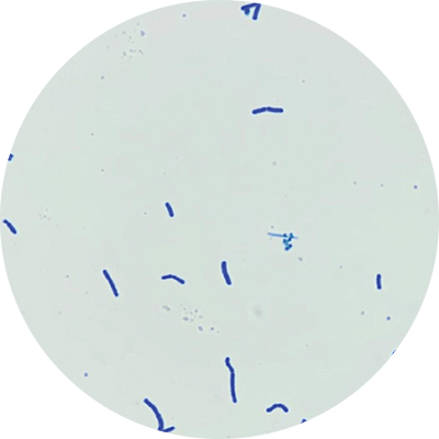 Lactobacillus gasseri