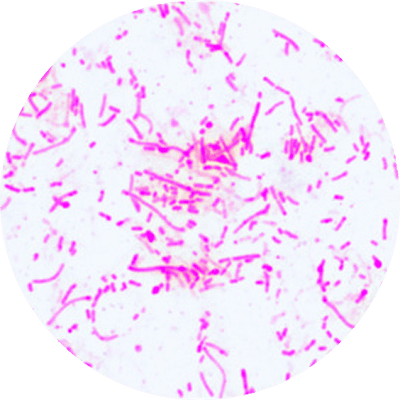 Lactobacillus jensenii