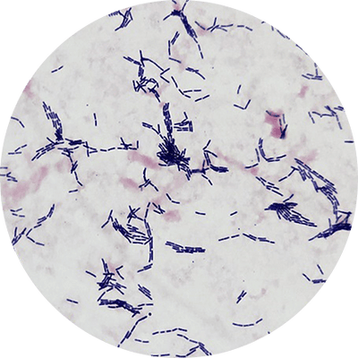 Lactobacillus rhamnosus